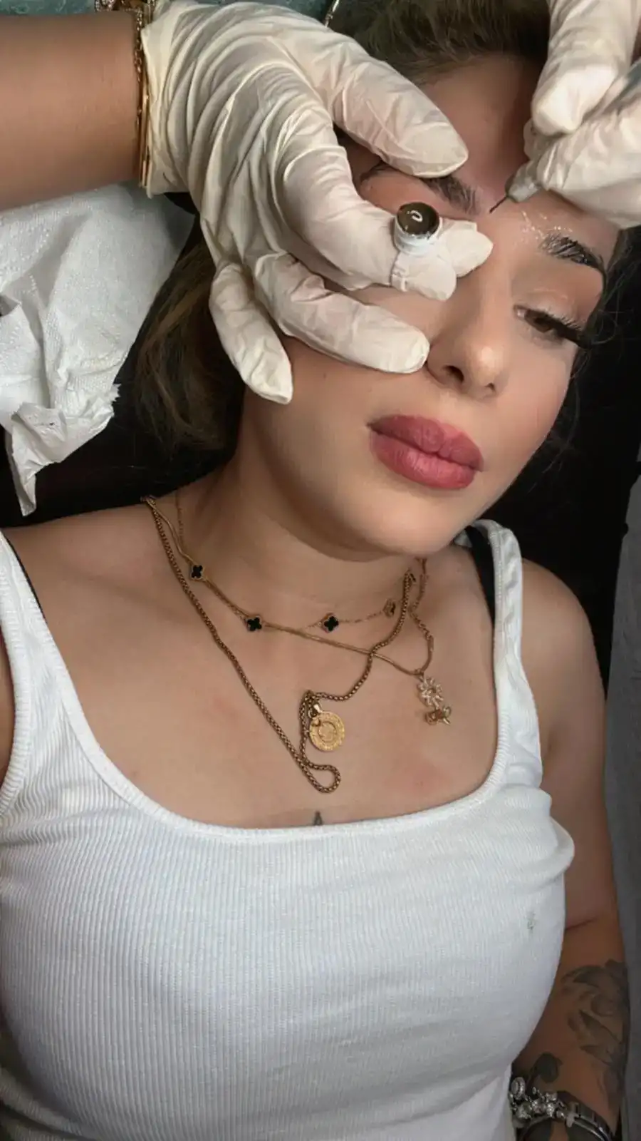 Epi Gold Life fotoğraf 3
