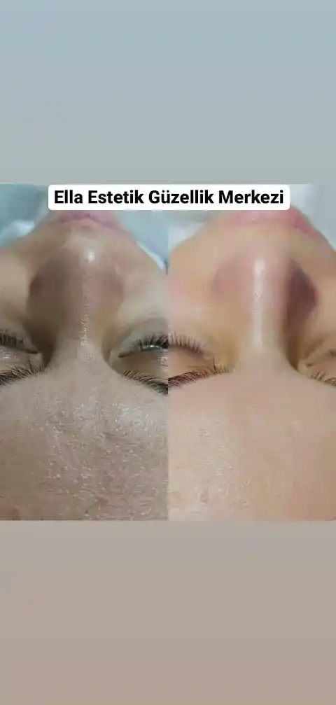 Şereflikoçhisar Ella Estetik ve Güzellik Merkezi fotoğraf 2