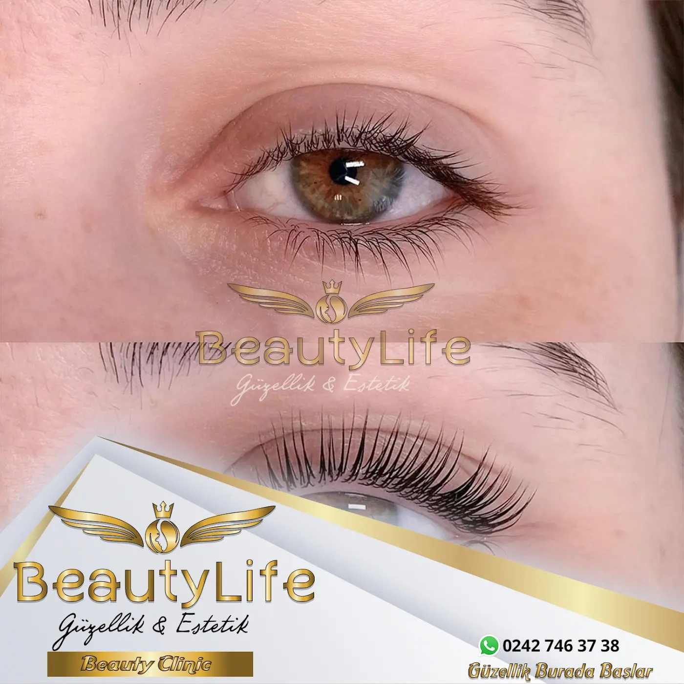 Beauty Life Güzellik Merkezi