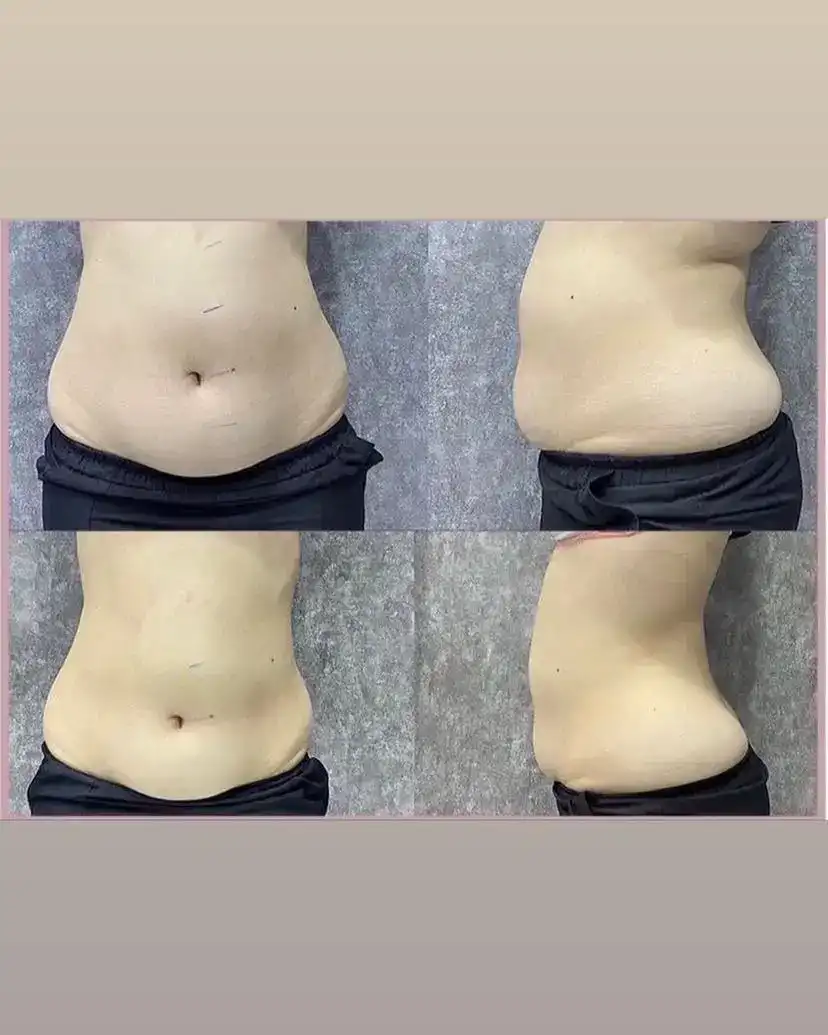 Aris Ezgi Doğan Antalya Güzellik Merkezi fotoğraf 3