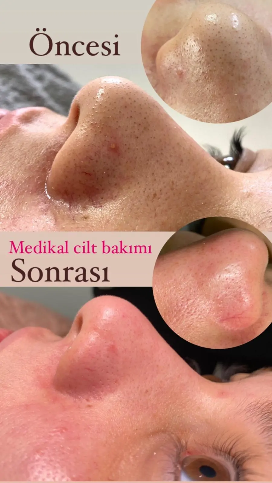Balıkesir Sion Vip fotoğraf 3