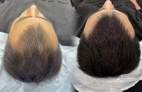 Fossette Güzellik Salonu fotoğraf 2