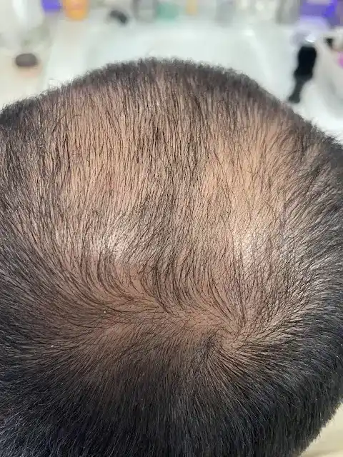 Çisil Efe Güzellik Ve Yaşam Merkezi fotoğraf 3