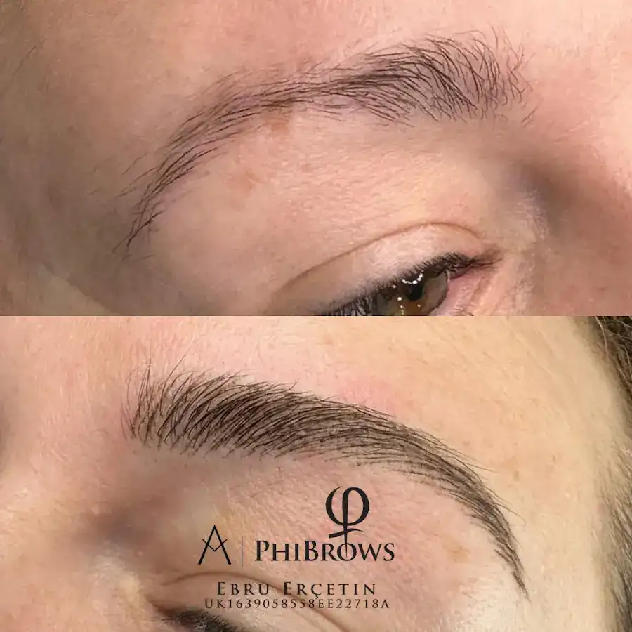 Denizli Güzellik Merkezi Beauty Proff