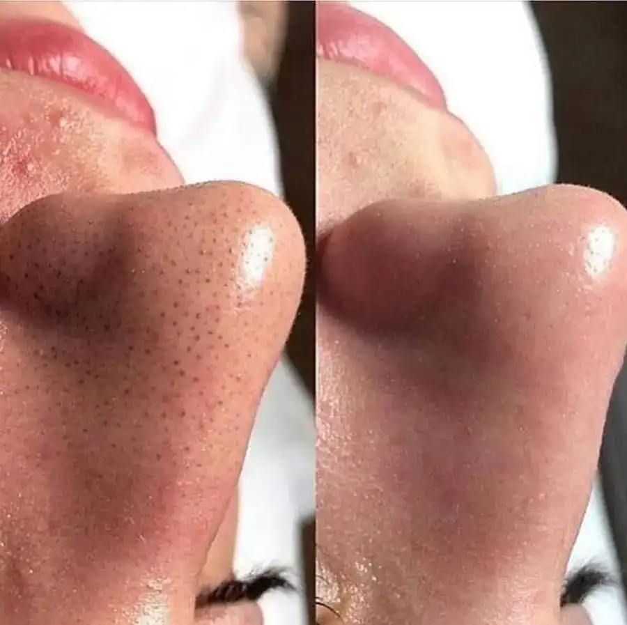 KONTES GÜZELLİK SALONU fotoğraf 3