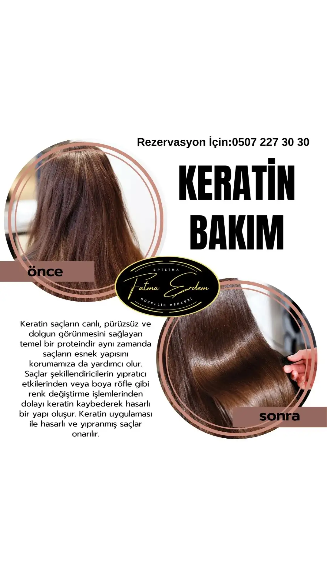 Fatma Erdem episima güzellik fotoğraf 2