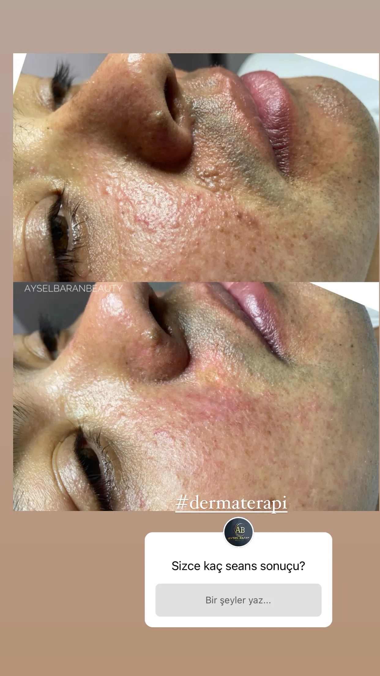 Aysel Baran Güzellik Salonu fotoğraf 2