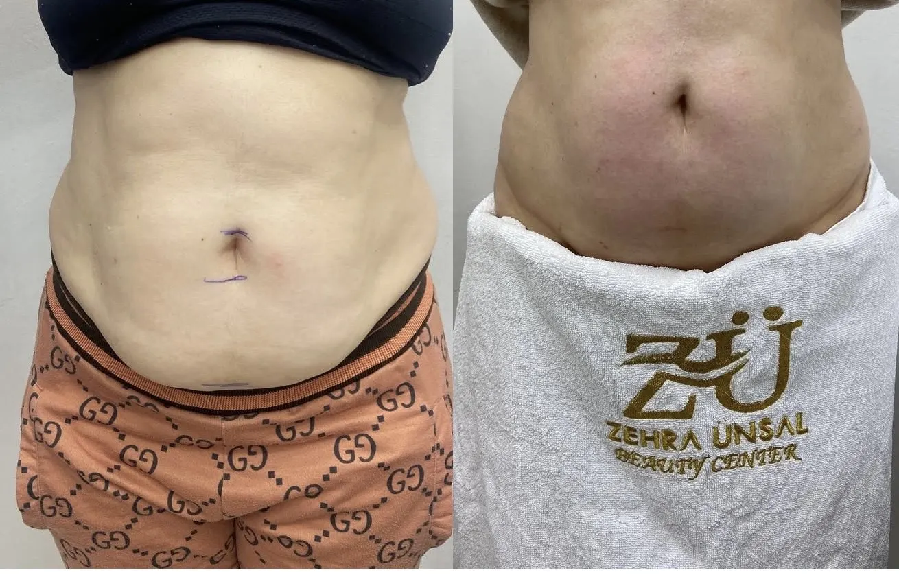 ZEHRA ÜNSAL GÜZELLİK SALONU fotoğraf 2