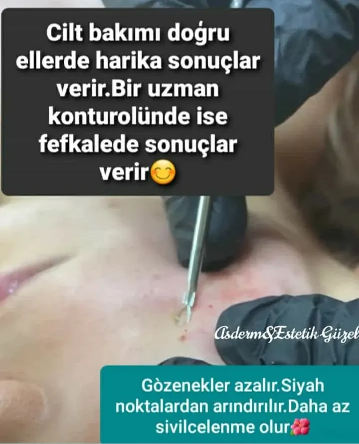 ASDERM GÜZELLİK SALONU Bahçelievler/Yenibosna /İstanbul