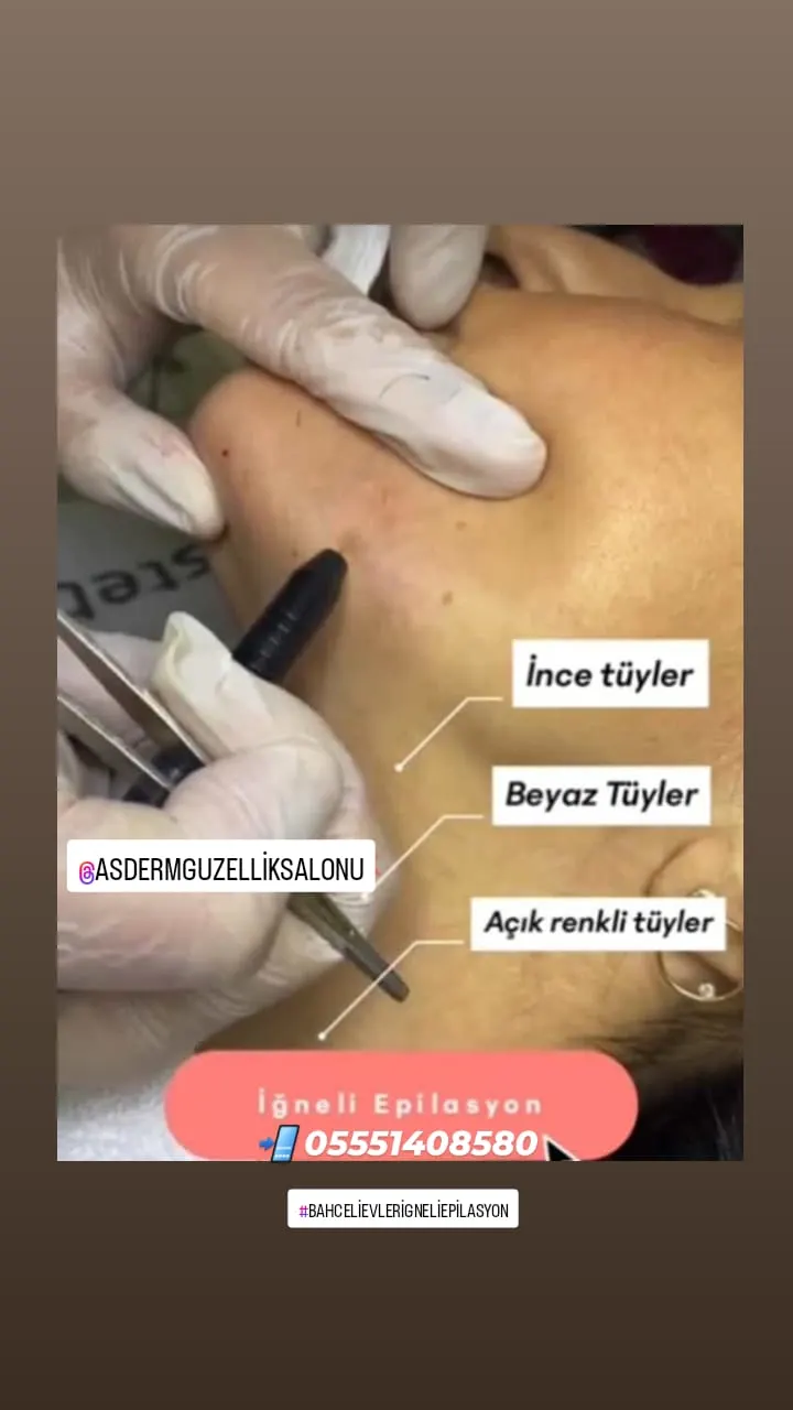ASDERM GÜZELLİK SALONU Bahçelievler/Yenibosna /İstanbul fotoğraf 3