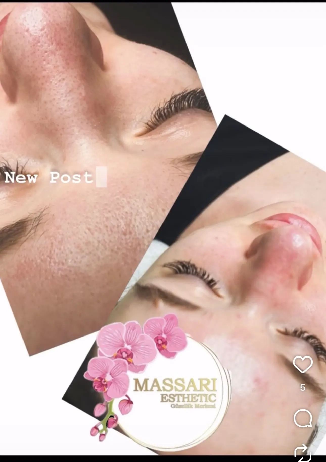 Massari Esthetic Güzellik Salonu | Protez Tırnak | İpek Kirpik | Hydrafacial Cilt Bakımı | Lazer Epilasyon |