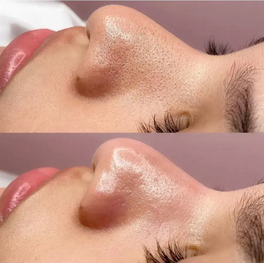 Catmosfer Güzellik Stüdyosu / Kadıköy Lazer Epilasyon / Kadıköy Hydrafacial Cilt Bakımı / Kadıköy Buz Lazer fotoğraf 3