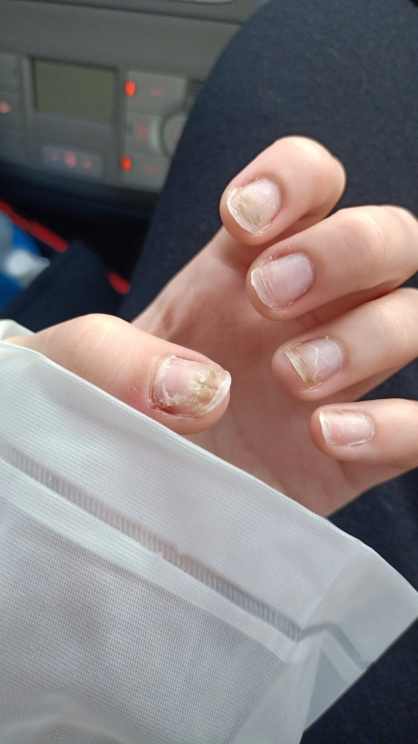 Derma Queen Güzellik Merkezi fotoğraf 3