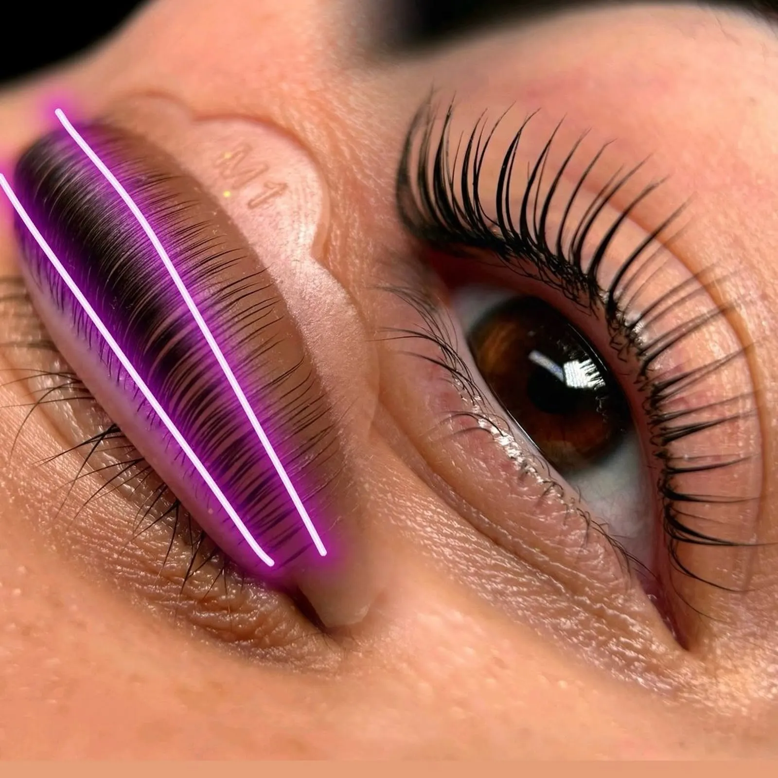 Tual Estetic Pendik Lazer Epilasyon / iğneli epilasyon / needle epilation / игольная эпиляция / Kirpik Lifting / Cilt bakım fotoğraf 3