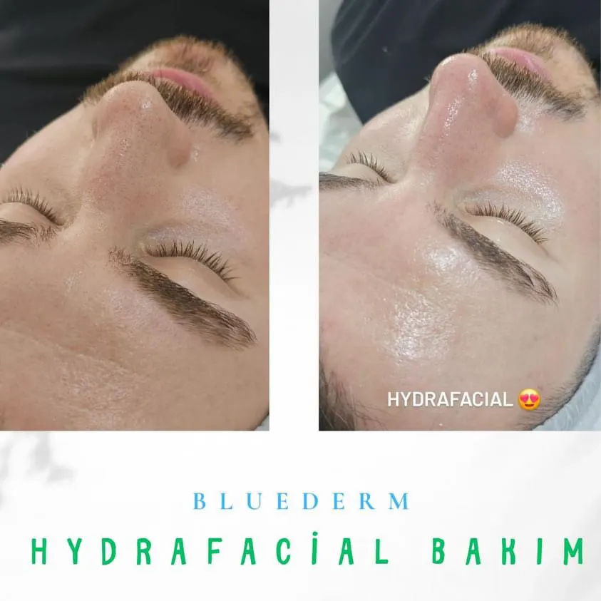 BLUEDERM GÜZELLİK MERKEZİ fotoğraf 2