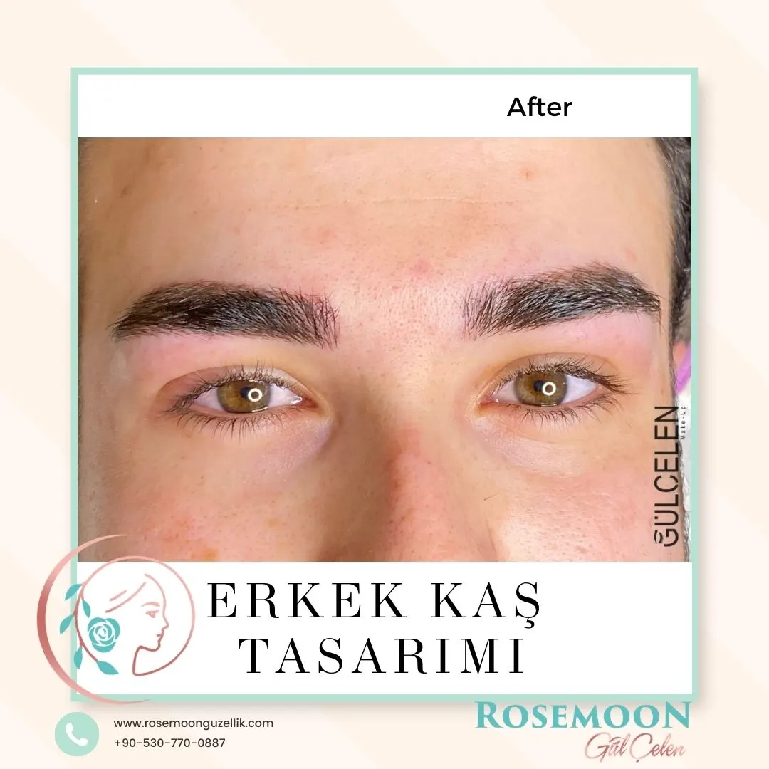 Rose Moon Güzellik Merkezi fotoğraf 3
