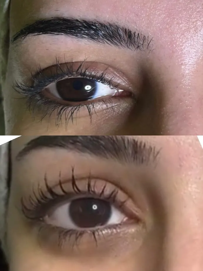 Yeşil Yaşam fotoğraf 3