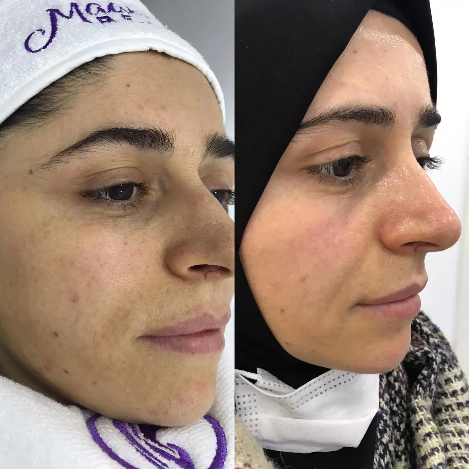Maabella beauty fotoğraf 2