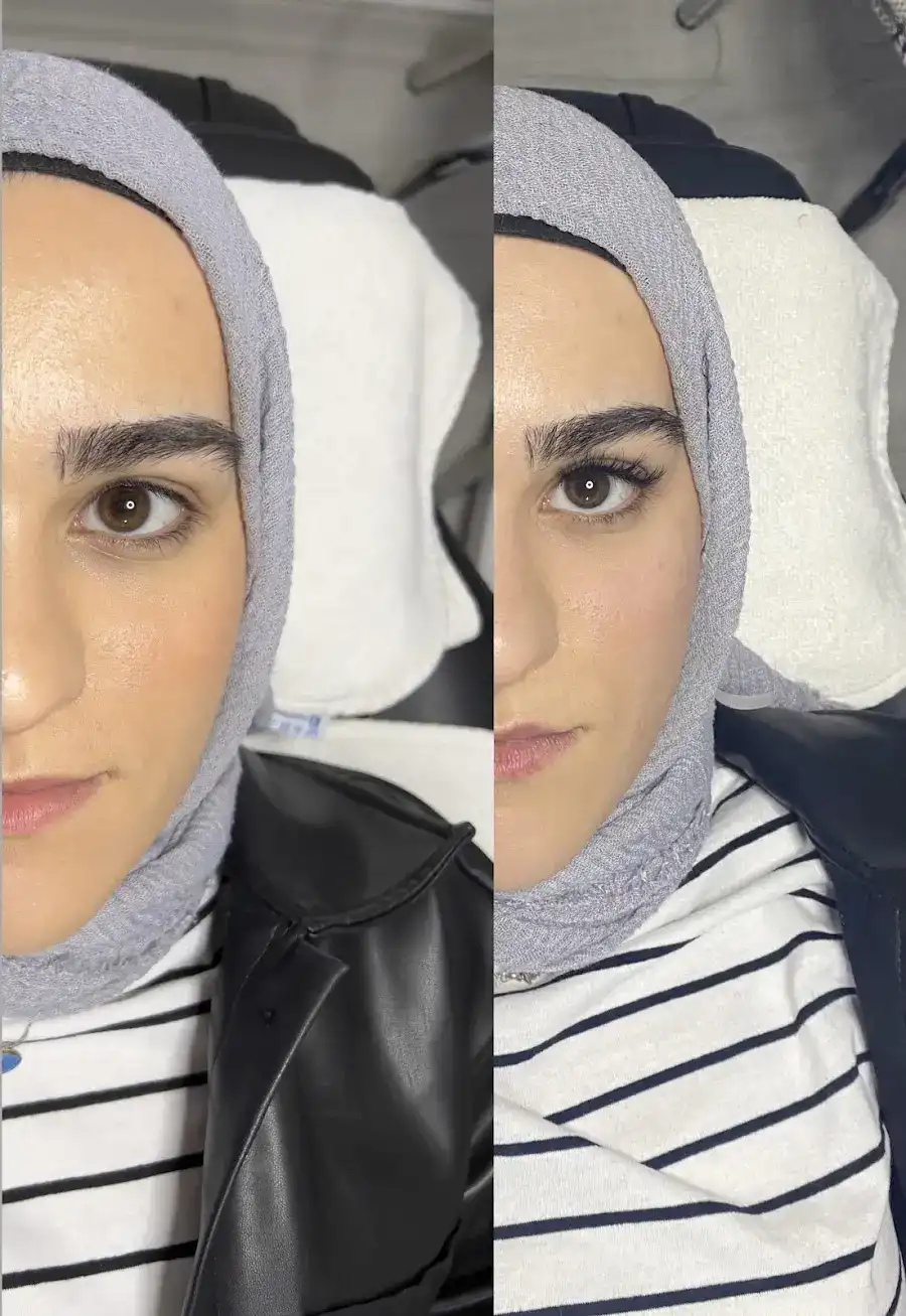 Buse Altıncı Güzellik Merkezi fotoğraf 2