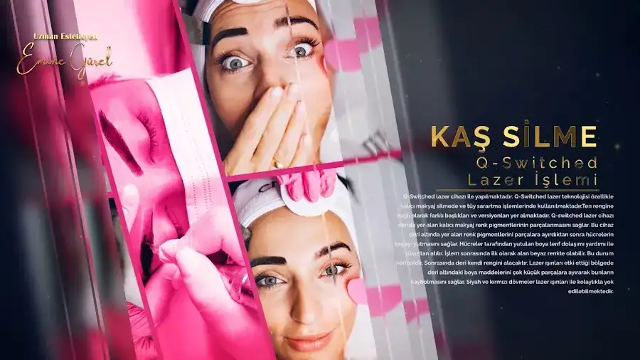 Trabzon Lazer Epilasyon fotoğraf 3